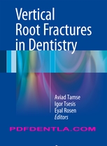 Vertical Root Fractures in Dentistry (pdf)